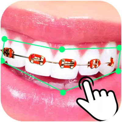 Braces Booth Stickers photo editor 2018